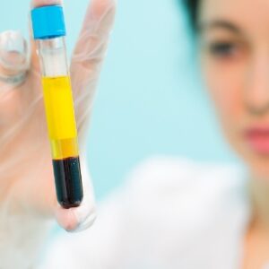 Técnicas de extracción de plasma