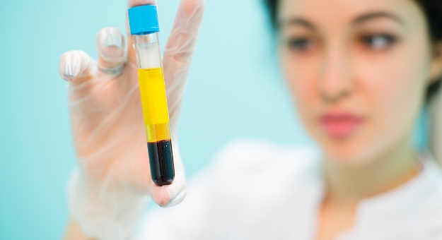 Técnicas de extracción de plasma